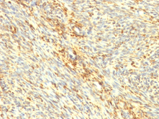 Anti-Transglutaminase 2 antibody [TGM2/419] used in IHC (Paraffin sections) (IHC-P). GTX35143