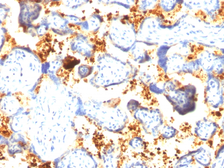 Anti-Transglutaminase 2 antibody [SPM592] used in IHC (Paraffin sections) (IHC-P). GTX35144