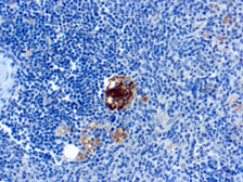 Anti-TRAP antibody [SPM601] used in IHC (Paraffin sections) (IHC-P). GTX35146