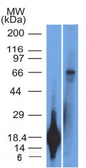 Anti-TRIM29 antibody [TRIM29/1042] used in Western Blot (WB). GTX35148