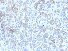 Anti-TRP1 antibody [TYRP1/807] used in IHC (Paraffin sections) (IHC-P). GTX35149