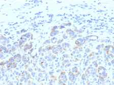 Anti-TRP1 antibody [SPM611] used in IHC (Paraffin sections) (IHC-P). GTX35150