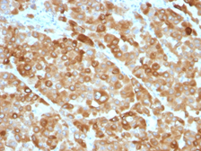 Anti-Tyrosinase antibody [OCA1/812] used in IHC (Paraffin sections) (IHC-P). GTX35153