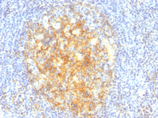 Anti-VCAM1 / CD106 antibody [VCAM1/843] used in IHC (Paraffin sections) (IHC-P). GTX35159