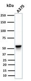 Anti-Vimentin antibody [SPM576] used in Western Blot (WB). GTX35161