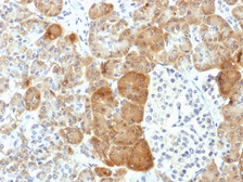 Anti-VLDL Receptor antibody [VLDLR/1337] used in IHC (Paraffin sections) (IHC-P). GTX35164