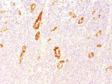 Anti-VWF antibody [3E2D10] used in IHC (Paraffin sections) (IHC-P). GTX35165
