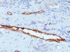 Anti-VWF antibody [IIIE2.34] used in IHC (Paraffin sections) (IHC-P). GTX35168