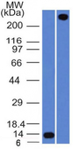 Anti-VWF antibody [VWF/1465] used in Western Blot (WB). GTX35169