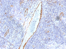 Anti-VWF antibody [F8/86] used in IHC (Paraffin sections) (IHC-P). GTX35171