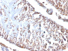 Anti-Wilms Tumor 1 antibody [6F-H2] used in IHC (Paraffin sections) (IHC-P). GTX35172