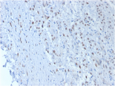 Anti-Wilms Tumor 1 antibody [SPM361] used in IHC (Paraffin sections) (IHC-P). GTX35173
