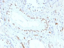 Anti-Wilms Tumor 1 antibody [WT1/857] used in IHC (Paraffin sections) (IHC-P). GTX35174