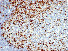 Anti-ZAP70 antibody [SPM362] used in IHC (Paraffin sections) (IHC-P). GTX35178