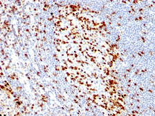 Anti-ZAP70 antibody [ZAP70/528] used in IHC (Paraffin sections) (IHC-P). GTX35179