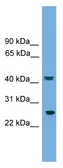 Anti-RAB35 antibody used in Western Blot (WB). GTX35180