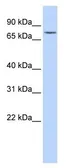 Anti-Galactosylceramidase antibody used in Western Blot (WB). GTX35182