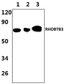 Anti-RHOBTB3 antibody used in Western Blot (WB). GTX35184