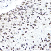 Anti-NBS1 antibody used in IHC (Paraffin sections) (IHC-P). GTX35197