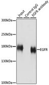Anti-EGFR antibody used in Immunoprecipitation (IP). GTX35199