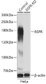 Anti-EGFR antibody used in Western Blot (WB). GTX35199