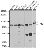 Anti-Merlin antibody used in Western Blot (WB). GTX35202