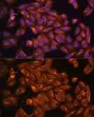 Anti-Merlin antibody used in Immunocytochemistry/ Immunofluorescence (ICC/IF). GTX35202