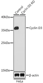 Anti-Cyclin D3 antibody used in Western Blot (WB). GTX35203