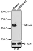 Anti-NCOA2 antibody used in Western Blot (WB). GTX35206