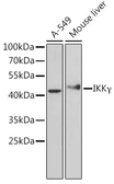 Anti-IKK gamma antibody used in Western Blot (WB). GTX35211
