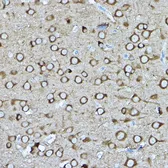 Anti-CRMP2 antibody used in IHC (Paraffin sections) (IHC-P). GTX35221