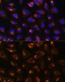 Anti-MEK2 antibody used in Immunocytochemistry/ Immunofluorescence (ICC/IF). GTX35223