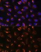 Anti-MEK2 antibody used in Immunocytochemistry/ Immunofluorescence (ICC/IF). GTX35223