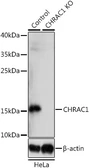 Anti-CHRAC1 antibody used in Western Blot (WB). GTX35225
