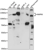 Anti-ERK3 antibody used in Western Blot (WB). GTX35227