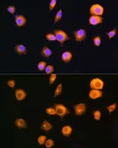 Anti-PKA R2 antibody used in Immunocytochemistry/ Immunofluorescence (ICC/IF). GTX35228