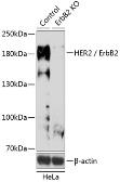 Anti-Her2 / ErbB2 antibody used in Western Blot (WB). GTX35231
