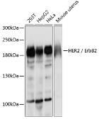 Anti-Her2 / ErbB2 antibody used in Western Blot (WB). GTX35231