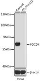 Anti-PDCD4 antibody used in Western Blot (WB). GTX35232