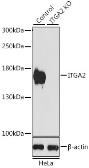Anti-Integrin alpha 2 antibody used in Western Blot (WB). GTX35237