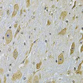 Anti-Integrin alpha 2 antibody used in IHC (Paraffin sections) (IHC-P). GTX35237