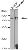 Anti-L1CAM antibody used in Western Blot (WB). GTX35239