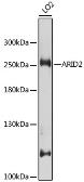 Anti-ARID2 antibody used in Western Blot (WB). GTX35240