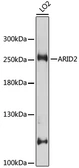 Anti-ARID2 antibody used in Western Blot (WB). GTX35240
