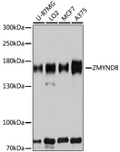 Anti-PRKCBP1 antibody used in Western Blot (WB). GTX35242