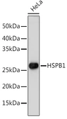 Anti-HSP27 antibody used in Western Blot (WB). GTX35243
