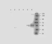 Anti-CD163 antibody used in Western Blot (WB). GTX35248