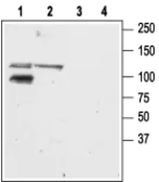 Anti-GluR6 antibody used in Western Blot (WB). GTX35259