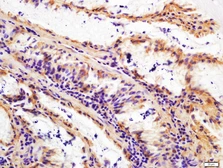 Anti-FAP antibody used in IHC (Paraffin sections) (IHC-P). GTX35261