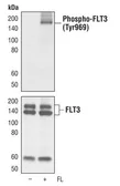 Anti-FLT3 (phospho Tyr969) antibody [T.602.6] used in Western Blot (WB). GTX36299
